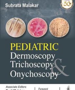 Pediatric Dermoscopy Trichoscopy & Onychoscopy