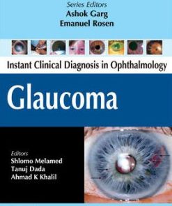 Instant Clinical Diagnosis in Ophthalmology Glaucoma