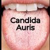 Comprehensive Treatise on Candida Auris Understanding, Diagnosis and Treatment Medical care and health