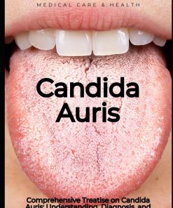 Comprehensive Treatise on Candida Auris Understanding, Diagnosis and Treatment Medical care and health