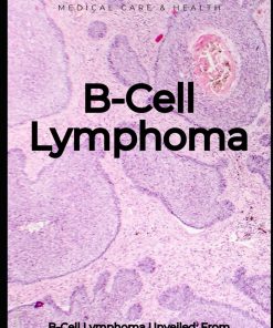 B Cell Lymphoma Medical care and health