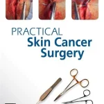 Practical Skin Cancer Surgery