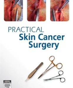 Practical Skin Cancer Surgery