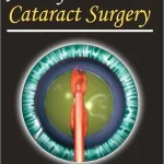 Atlas of Cataract Surgery