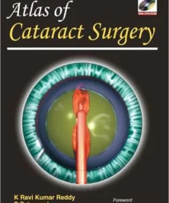 Atlas of Cataract Surgery