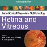 Instant Clinical Diagnosis in Ophthalmology Retina and Vitreous
