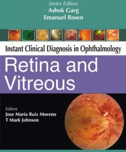 Instant Clinical Diagnosis in Ophthalmology Retina and Vitreous