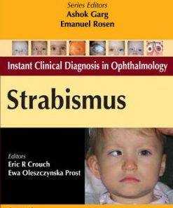 Instant Clinical Diagnosis in Ophthalmology Strabismus