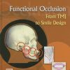 Functional Occlusion From TMJ to Smile Design