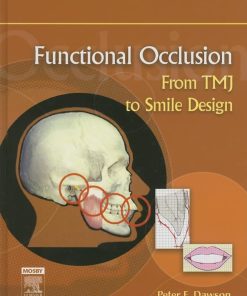 Functional Occlusion From TMJ to Smile Design