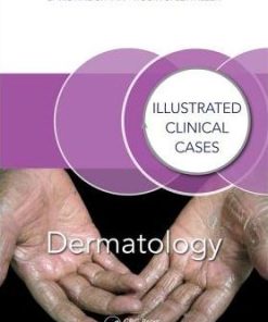 Dermatology Illustrated Clinical Cases