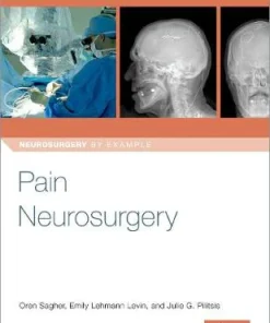 Pain Neurosurgery