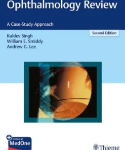 Ophthalmology Review A Case Study Approach 2nd Edition