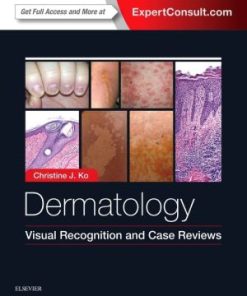 Dermatology Visual Recognition and Case Reviews