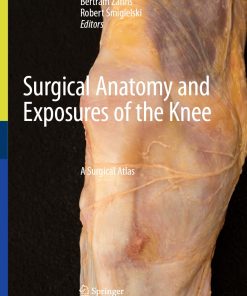Surgical Anatomy and Exposures of the Knee A Surgical Atlas