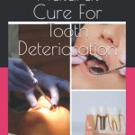 Natural Cure For Tooth Deterioration How to cure for Tooth Decay Natural in your own Convenience with cavity and nutrition