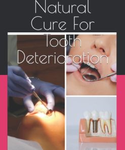 Natural Cure For Tooth Deterioration How to cure for Tooth Decay Natural in your own Convenience with cavity and nutrition