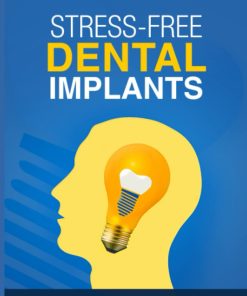 Stress Free Dental Implants Re energize Your Career with Dental Implants