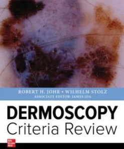 Dermoscopy Criteria Revie