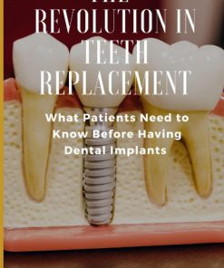 The Revolution in Teeth Replacement What Patients Need to Know Before Having Dental Implants