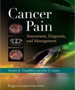 Cancer Pain Assessment Diagnosis and Management