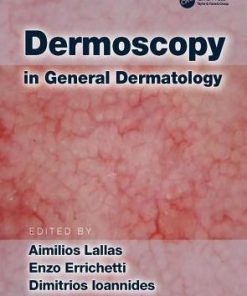 Dermoscopy in General Dermatology