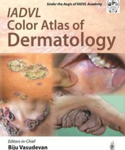 Color Atlas of Dermatology
