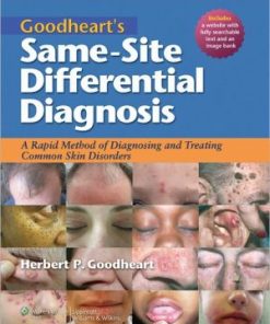Goodheart's Same Site Differential Diagnosis