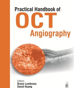 Practical Handbook of OCT Angiography