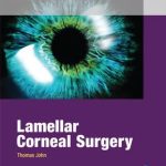 Lamellar Corneal Surgery