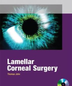 Lamellar Corneal Surgery
