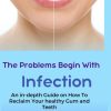 The Problems Begin With Infection An in depth Guide on How to Reclaim your healthy Gum and Teeth