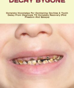 CAVITIES & TOOTH DECAY BYGONE