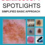 Dermoscopy Spotlights Simplified Basic Approach 2nd Edition