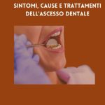 Ascesso Dentale Sintomi Cause E Trattamenti Dell'ascesso Dentale