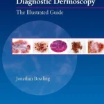 Diagnostic Dermoscopy The Illustrated Guide