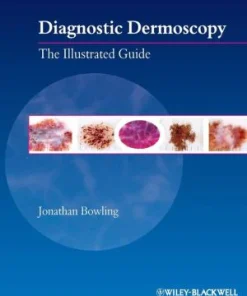 Diagnostic Dermoscopy The Illustrated Guide