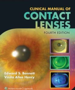 Clinical Manual of Contact Lenses 4th Edition