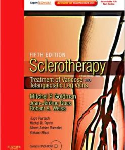 Sclerotherapy Treatment of Varicose and Telangiectatic Leg Veins 5th Edition