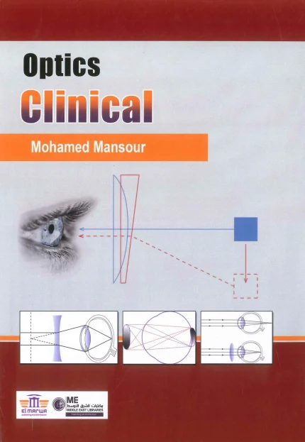 Clinical Optics