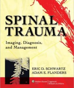Spinal Trauma Imaging Diagnosis and Management