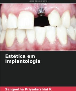 Estética em Implantologia