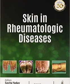 Skin in Rheumatologic Diseases