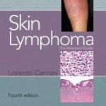 Skin Lymphoma The Illustrated Guide 4th Edition