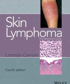 Skin Lymphoma The Illustrated Guide 4th Edition