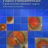 Phaco Fundamentals A Guide for Trainee Ophthalmic Surgeons