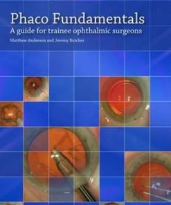 Phaco Fundamentals A Guide for Trainee Ophthalmic Surgeons