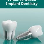 Evidence Based Implant Dentistry