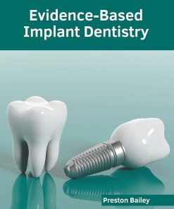 Evidence Based Implant Dentistry