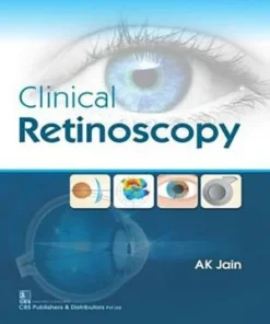 Clinical Retinoscopy